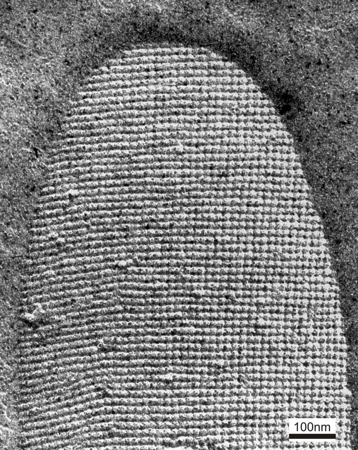 TEM micrograph of an S-layer carrying bacterial cell